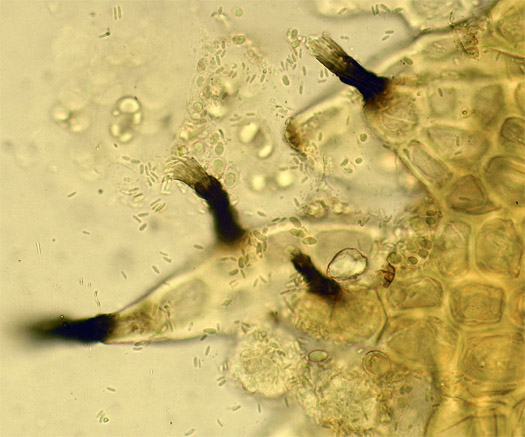 Mystery liverwort fungus