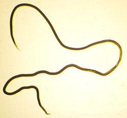 An adult lungworm, almost 3 inches long