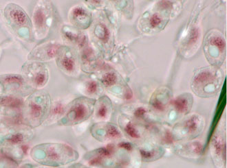 Stained spores of Furia ithacensis