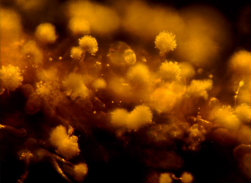 Aspergillus collembolorum in Baltic amber, courtesy of Dr. A. Schmidt