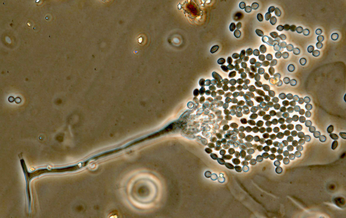 Aspergillus from a leather car seat.