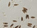 Pestalotiopsis spores