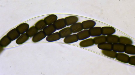 8 spores of Sporormiella australis, by Bjorn Wergen